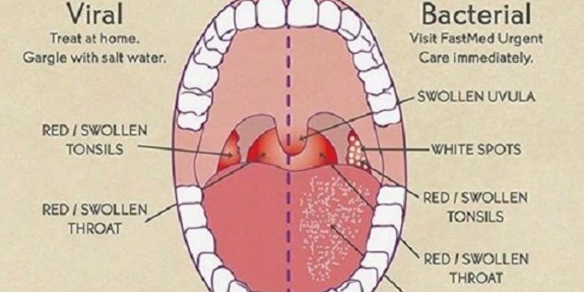 Article Picture